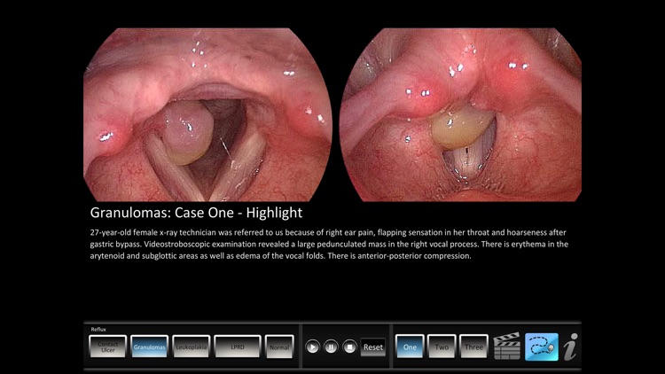 Vocal Pathology: Reflux screenshot-0