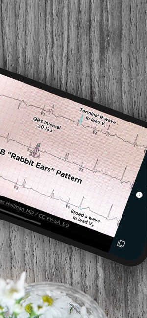 USMLE Clinic(圖6)-速報App