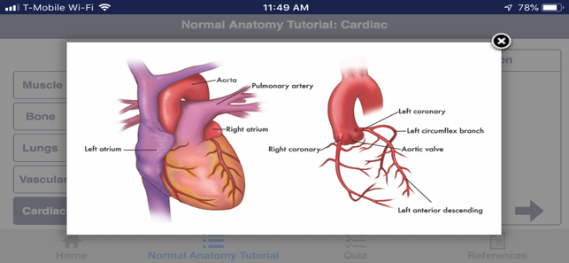 CTisus Chest Atlas 3D CRT(圖3)-速報App