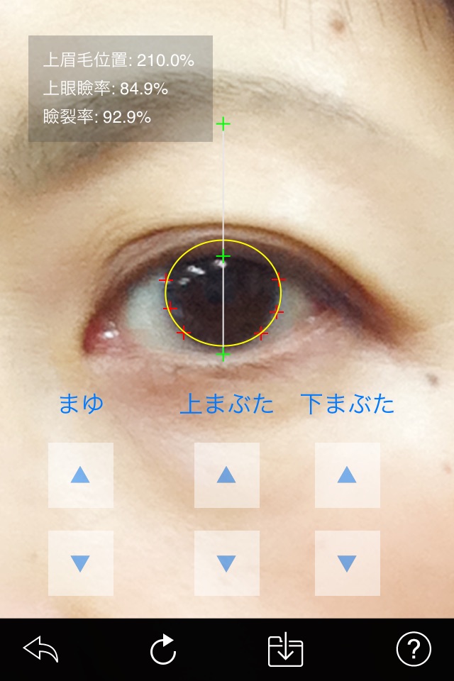 Eyelid screenshot 2