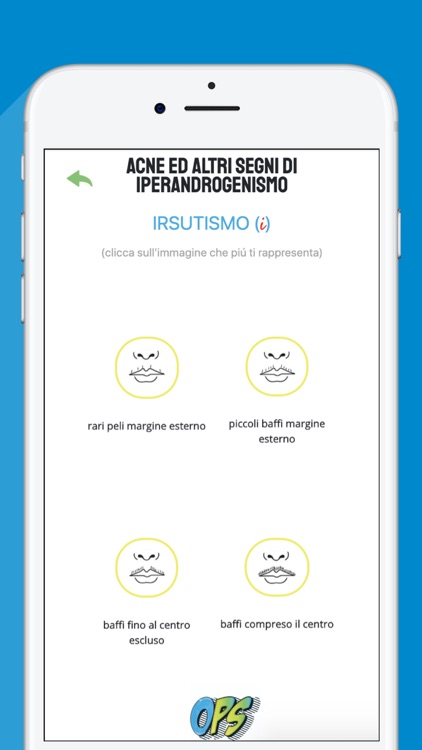 OvaioPolicistico OPS