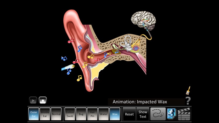 Ear Disorders: Outer Middle screenshot-3