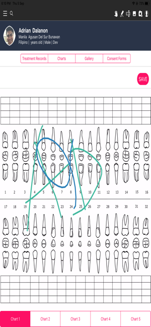 RackCharts(圖5)-速報App