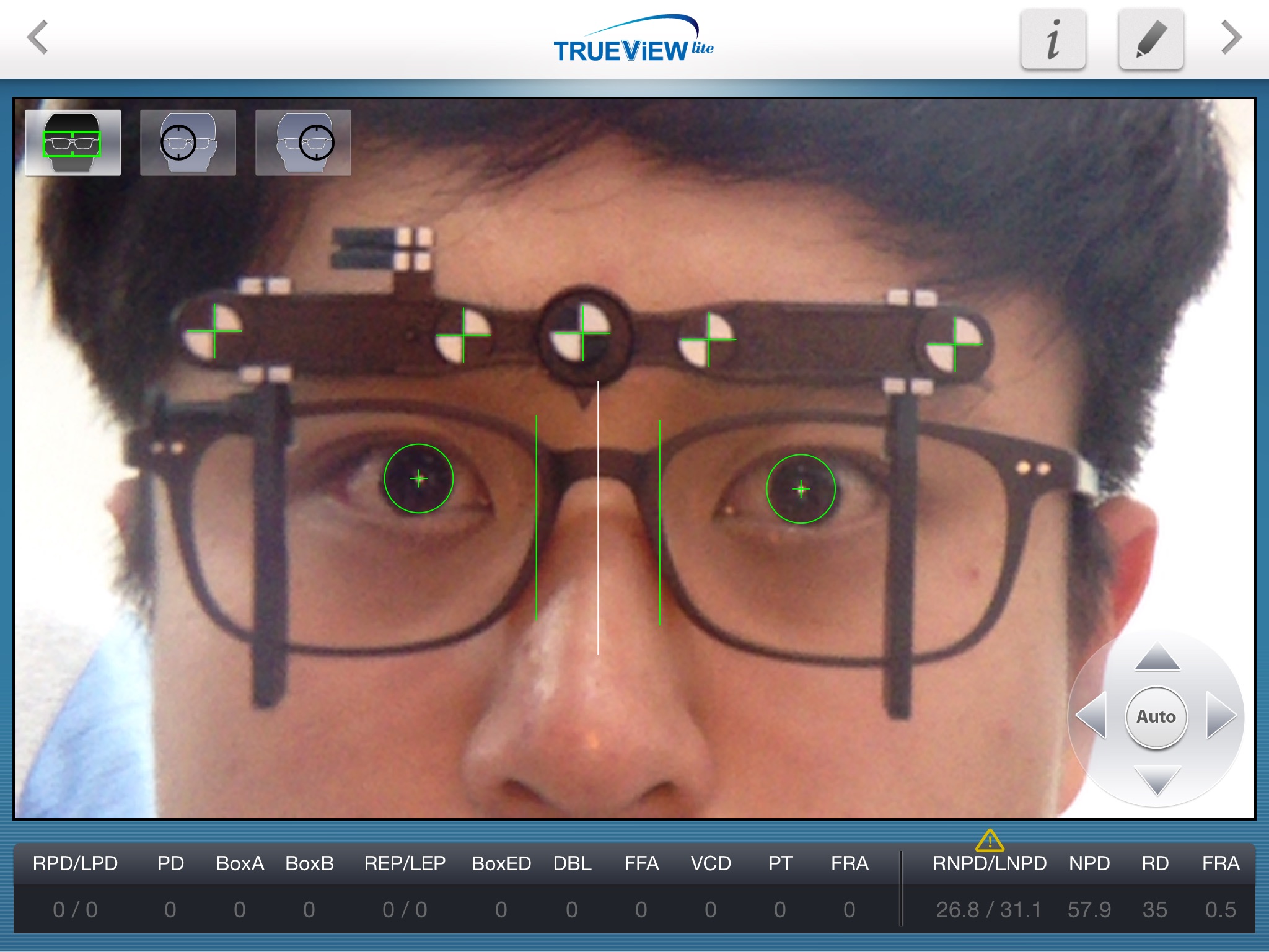 TRUEVIEW lite screenshot 3