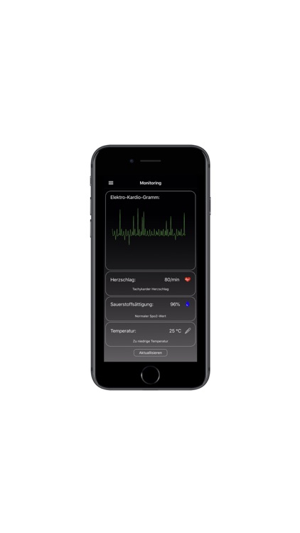 DSTN-Monitoring