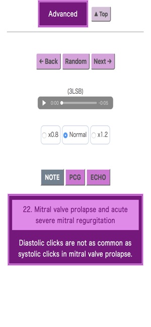 Pocket Heart Sound(圖3)-速報App