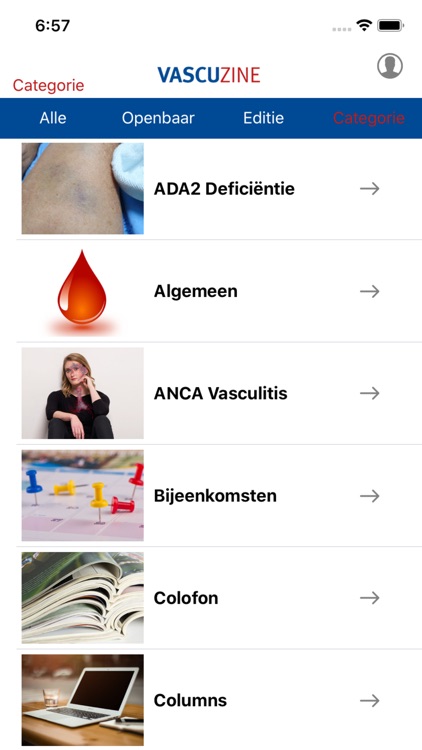 Vascuzine