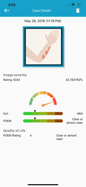 Eczema-Less, your AI guide(圖4)-速報App