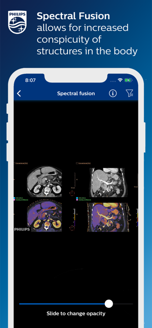 Philips IQon Spectral CT(圖4)-速報App