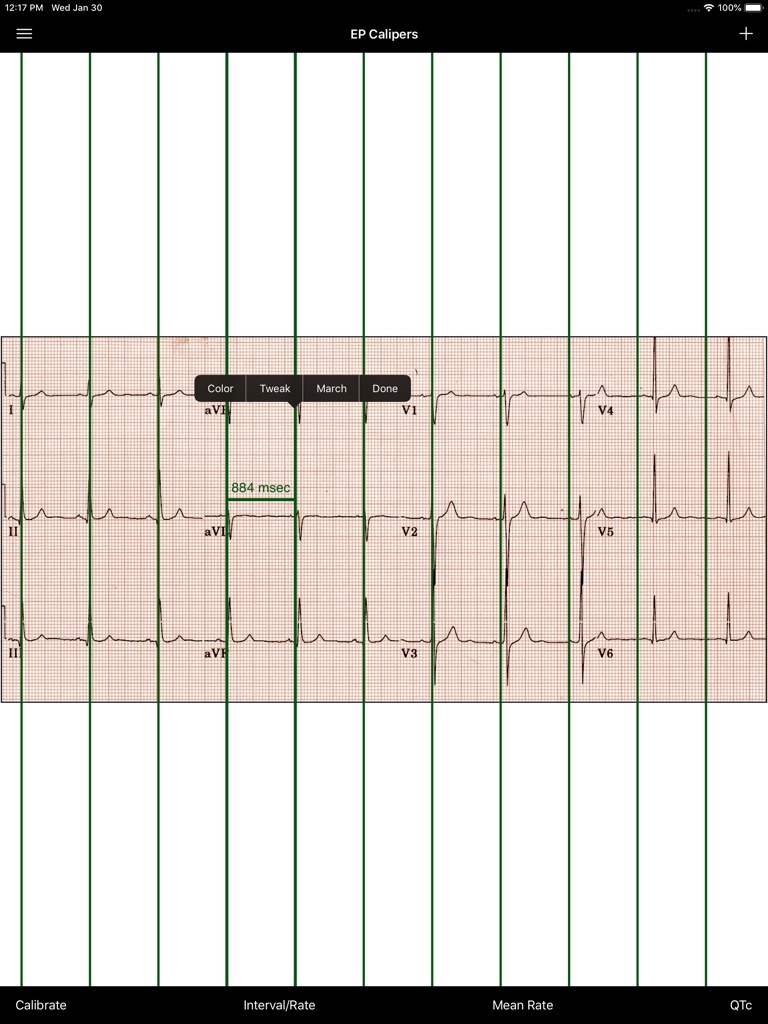 【图】EP Calipers(截图3)