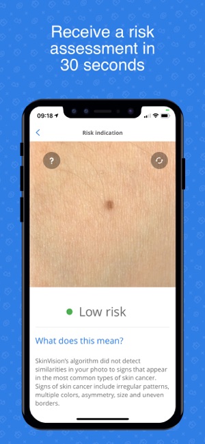 SkinVision Detect Skin Cancer(圖2)-速報App