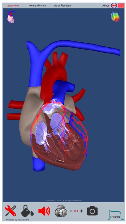 Intelligent Heart Sim AFib