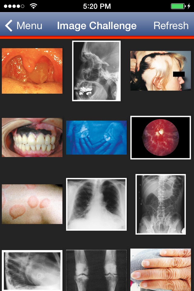 NEJM Image Challenge screenshot 2