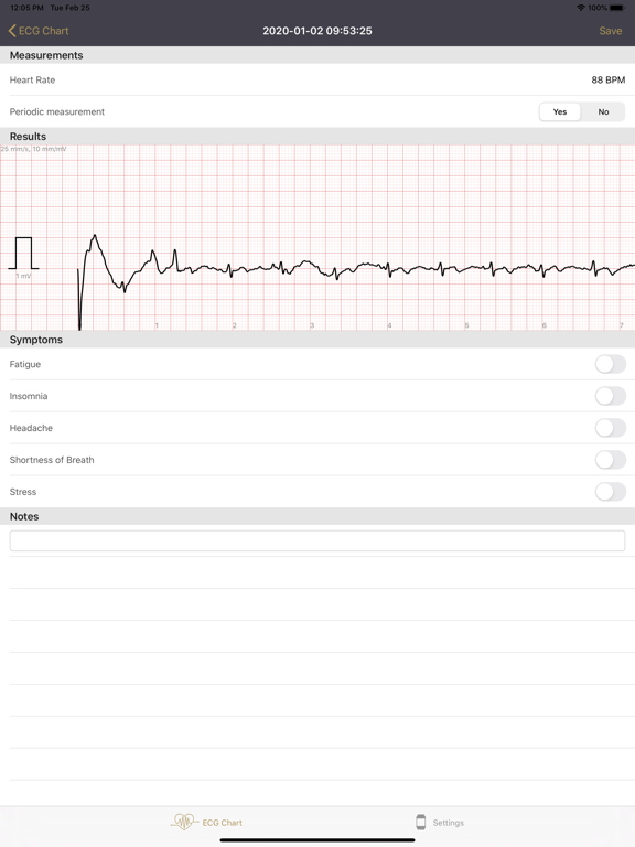 Screenshot #6 pour HUINNO MEMO for ECG