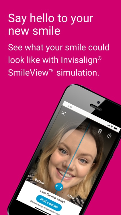 My Invisalign