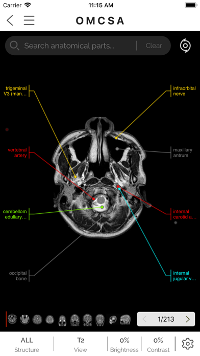 OMCSA k-anatomy screenshot 4