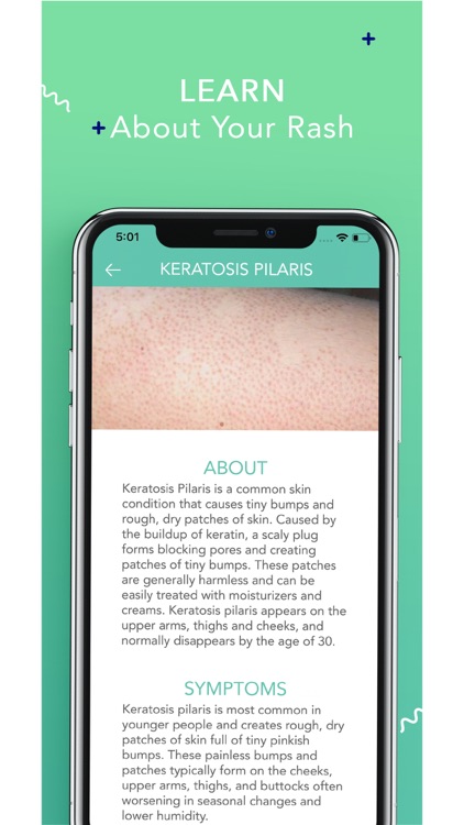 Rash ID