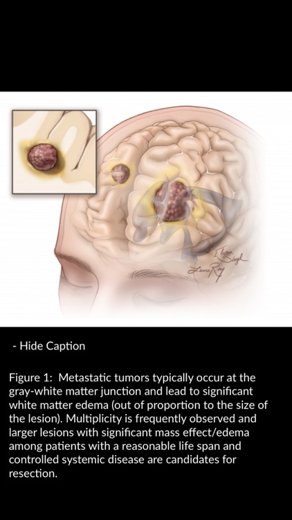 Neurosurgical Atlas screenshot-3