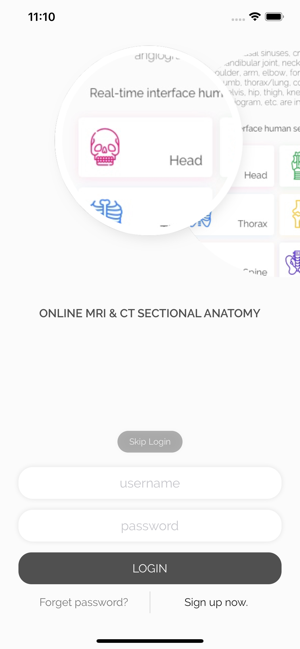 OMCSA k-anatomy(圖1)-速報App