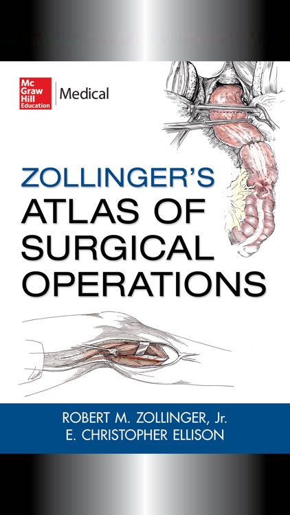 Zollinger Atlas of Surgery 9E