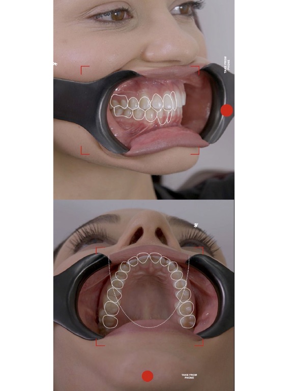 Dental Shootingのおすすめ画像6