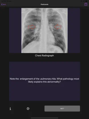 Screenshot 2 Basic Radiology iphone