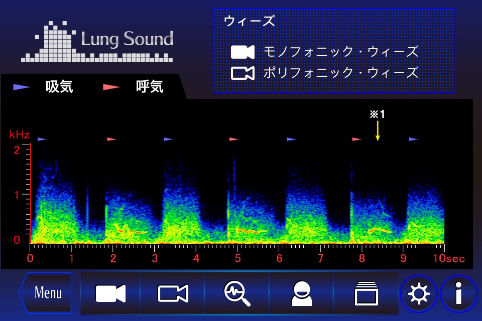 肺の聴診トレーニング - 見える肺音 screenshot 3