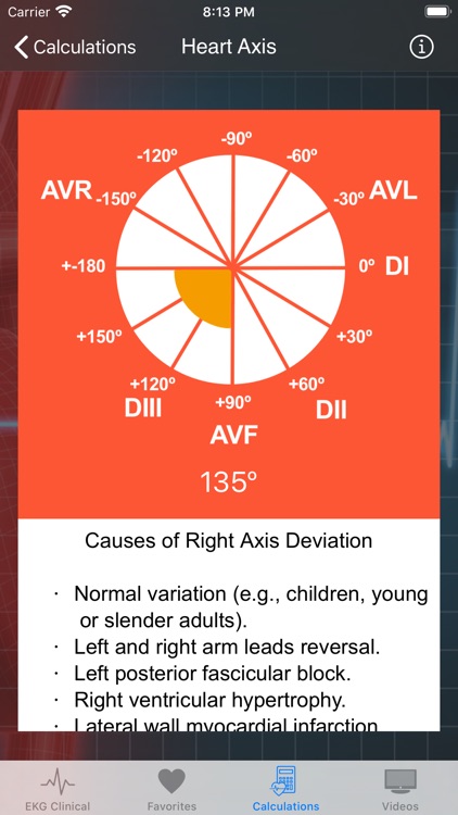 EKG Clinical screenshot-6