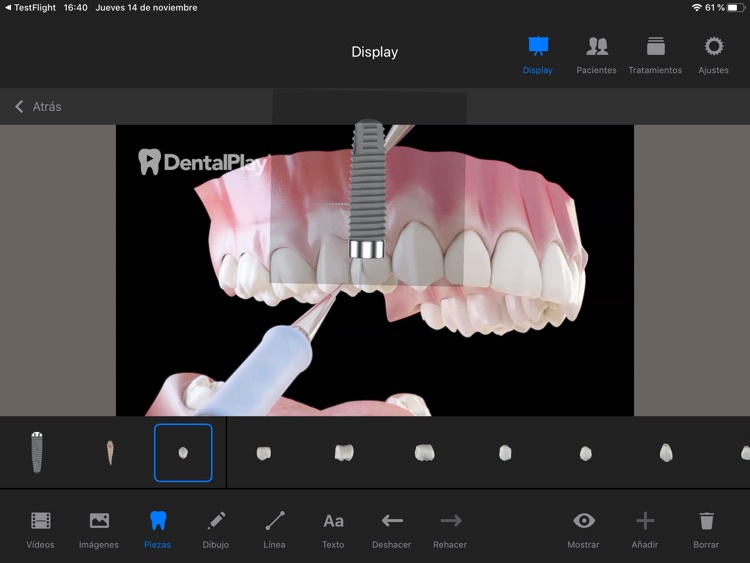 Dentool screenshot-4