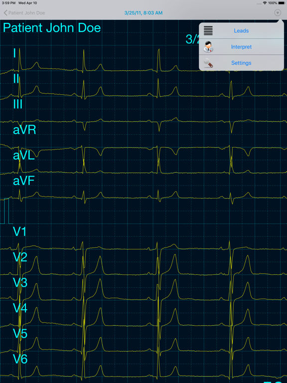 Screenshot #6 pour Cardiax