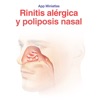 Rinitis alérgica y poliposis
