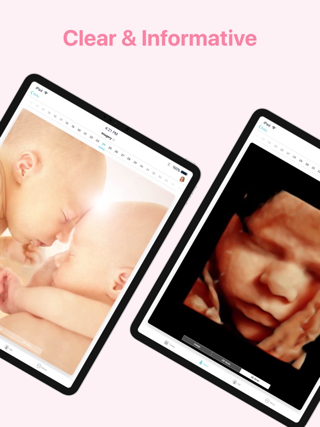 Pregnancy + | Tracker App