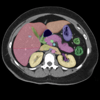 Anatomy on Radiology CT - Lieu Duong