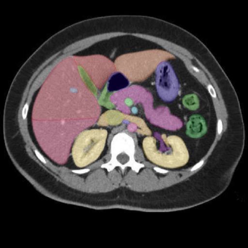 Anatomy on Radiology CT