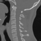 App Icon for CT Cervical Spine App in United States IOS App Store