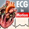 ECG in Motion – der Blick ins schlagende Herz