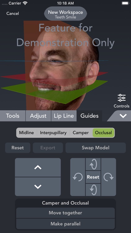 Bellus3D Dental Pro screenshot-5