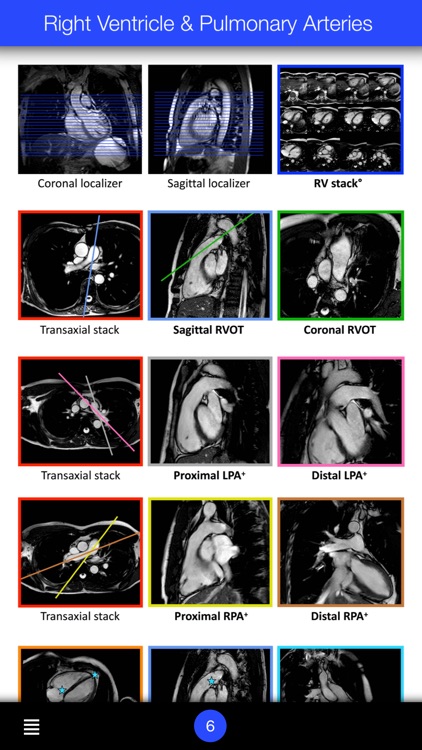 CMR Guide CHD screenshot-3