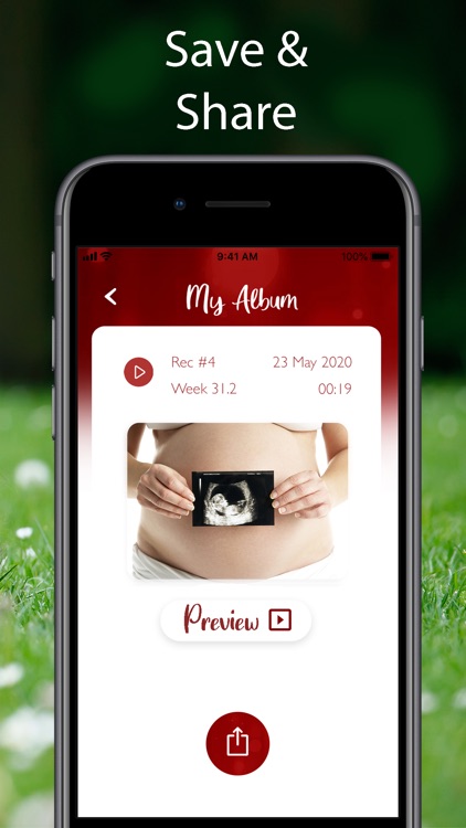 My Baby Beat: Hear Fetal Heart