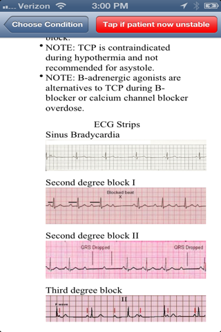 ACLS Fast - náhled
