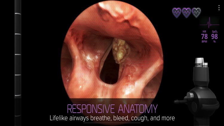 Airway Ex