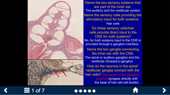 Neuroanatomy - SecondLook(圖3)-速報App