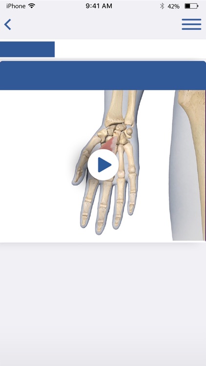 3D Spasticity