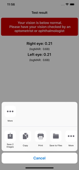 Eye Test - Visual Acuity(圖5)-速報App