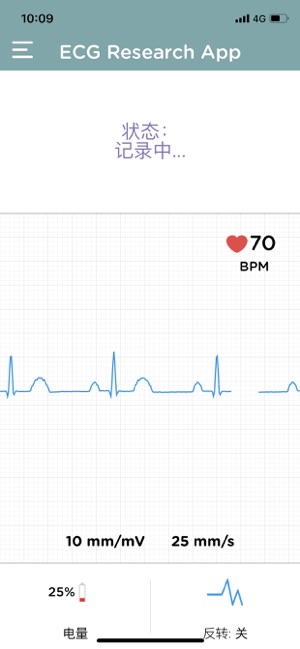 Vitals Monitor-ECG Research(圖2)-速報App