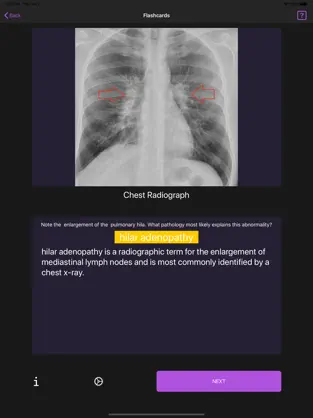 Captura de Pantalla 3 Basic Radiology iphone