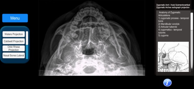 Anatomy and X-Ray Positioning(圖3)-速報App