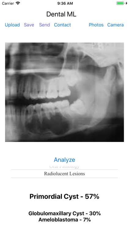 Dental ML screenshot-3