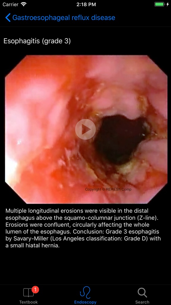 【图】ENDO3® Gastrointestinal Atlas(截图3)