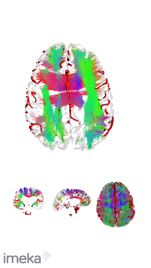 NeuroNavigator(圖5)-速報App